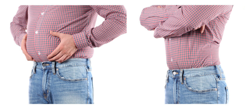Before and after Weight loss 201141702